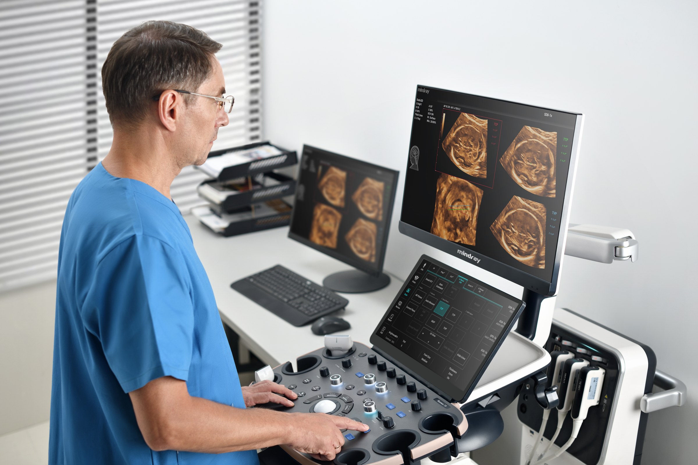 Nuewa i9 - Solve Medical