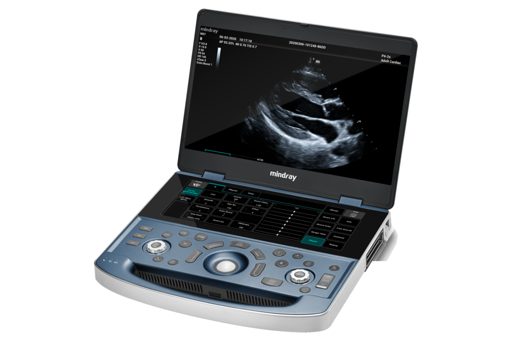 MX7