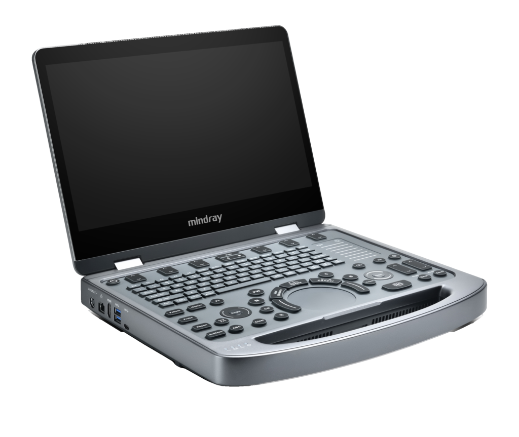MX3
